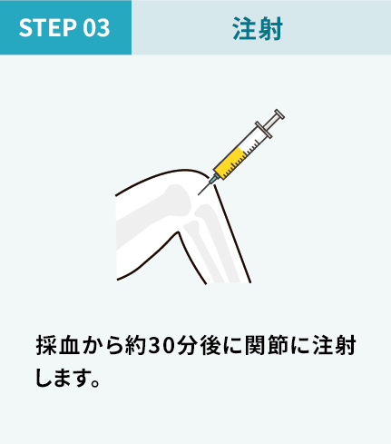 PRP療法 STEP_3